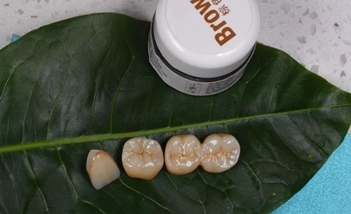 全瓷牙和烤瓷牙的区别